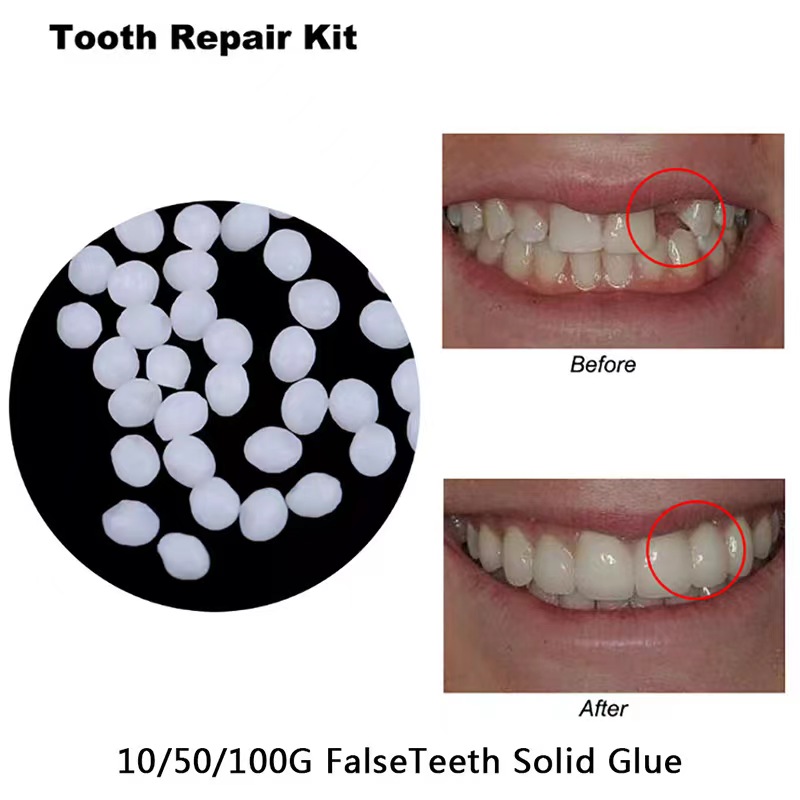 Teeth Whitening Mask - Kit de réparation de dents 10