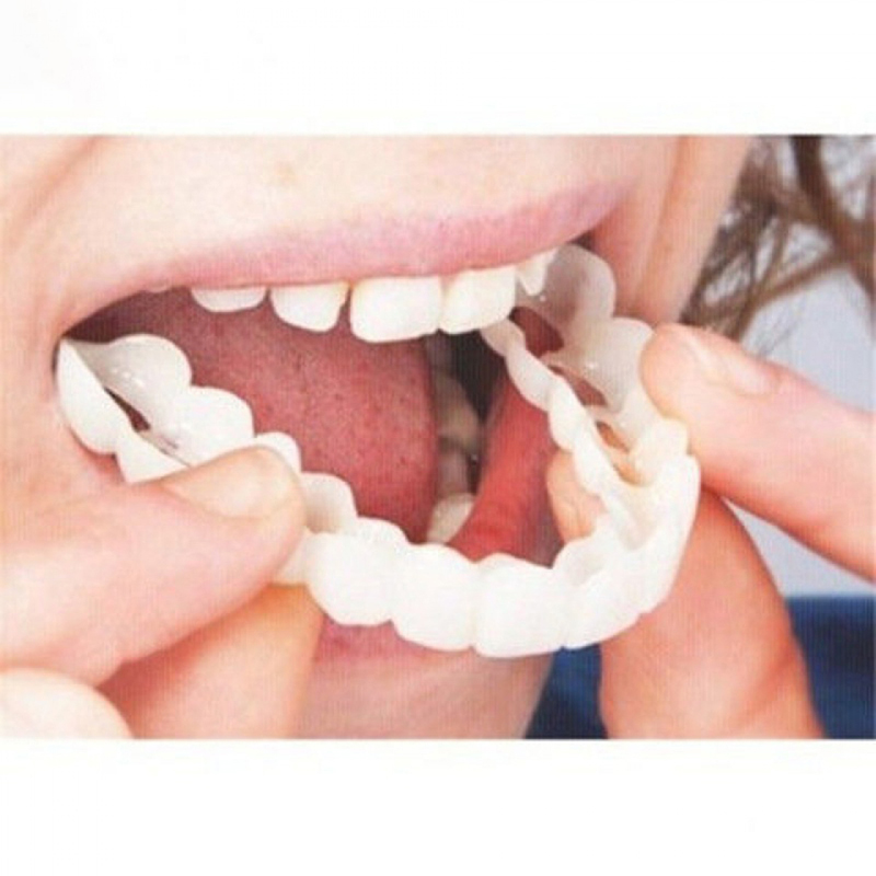 Teeth Whitening With Braces - Ajustement parfait couverture de fausses dents