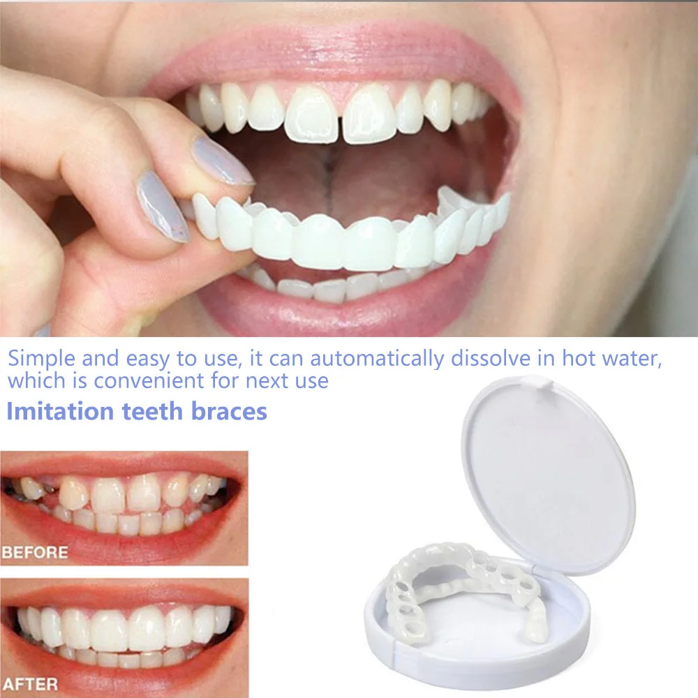 Teeth Whitening With Braces - Sdottor faux dents bretelles artificielles blanchiment