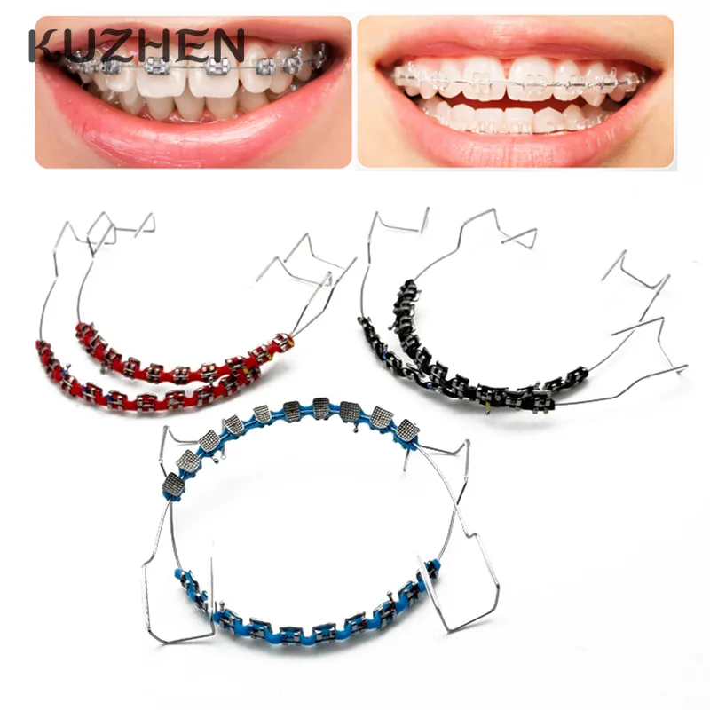 Teeth Whitening With Braces - 1 paire de supports colorés, faux