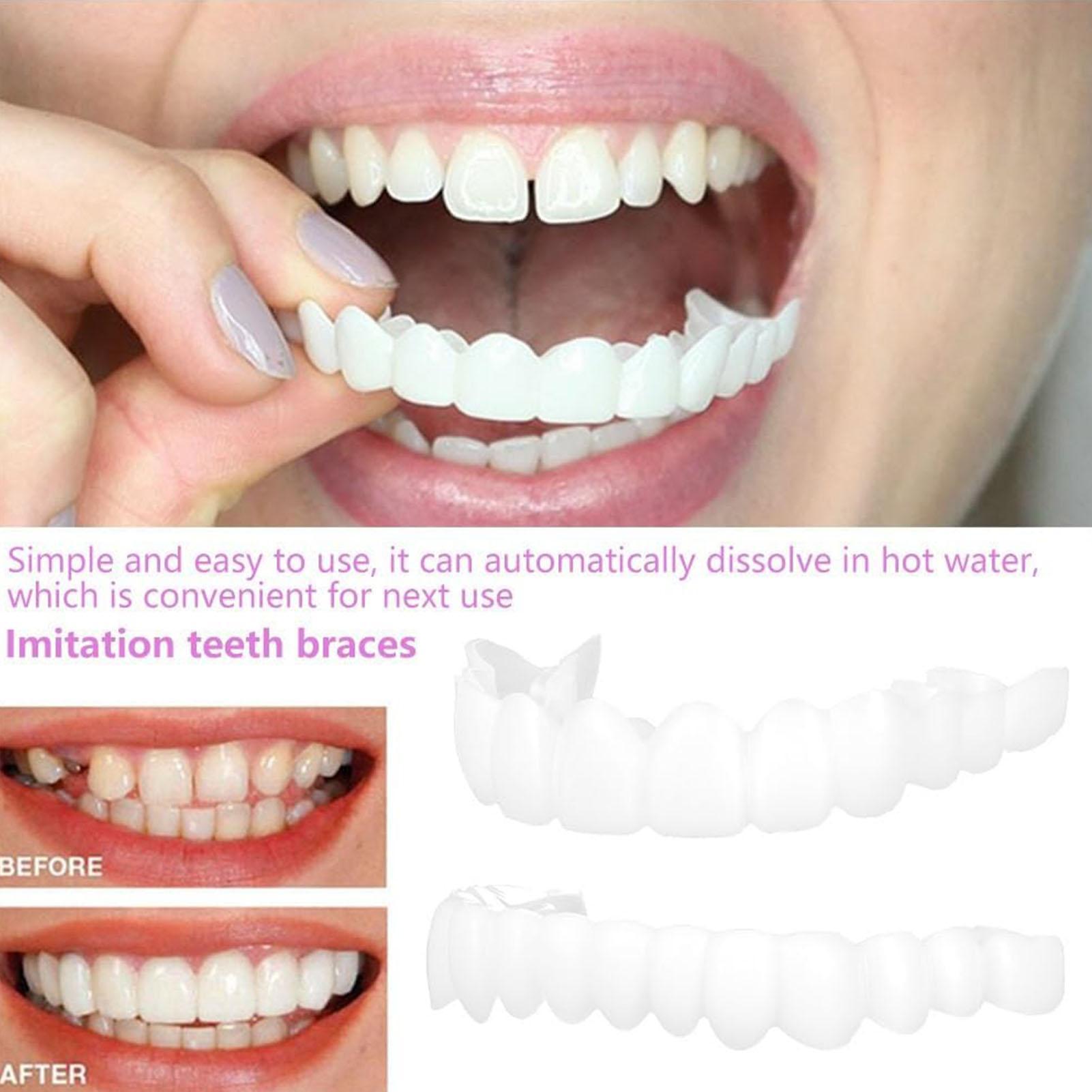 Teeth Whitening Mask - 2 pièces hommes femmes dents temporaires