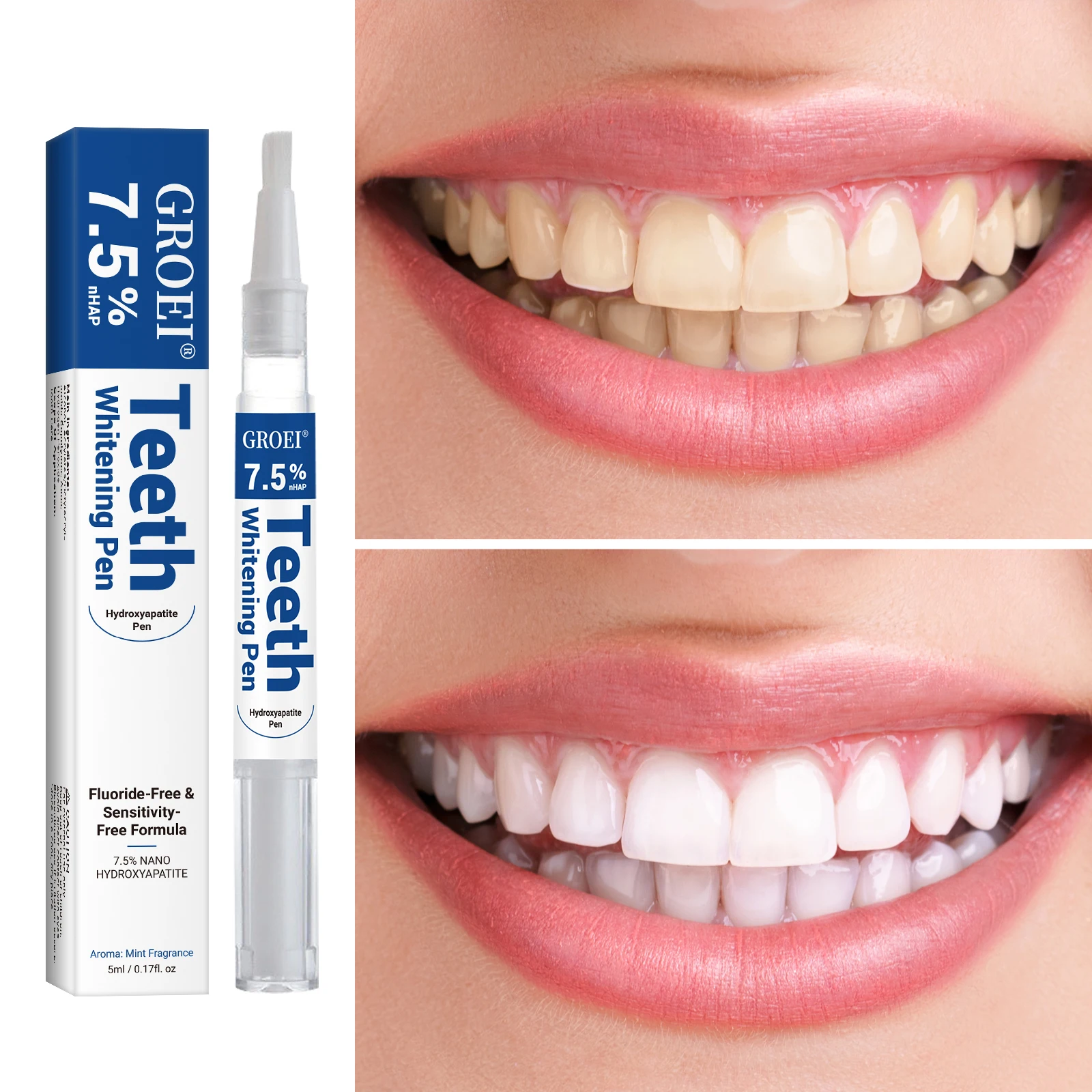 Stylo de blanchiment des dents - Teeth Whitening Results avis et prix