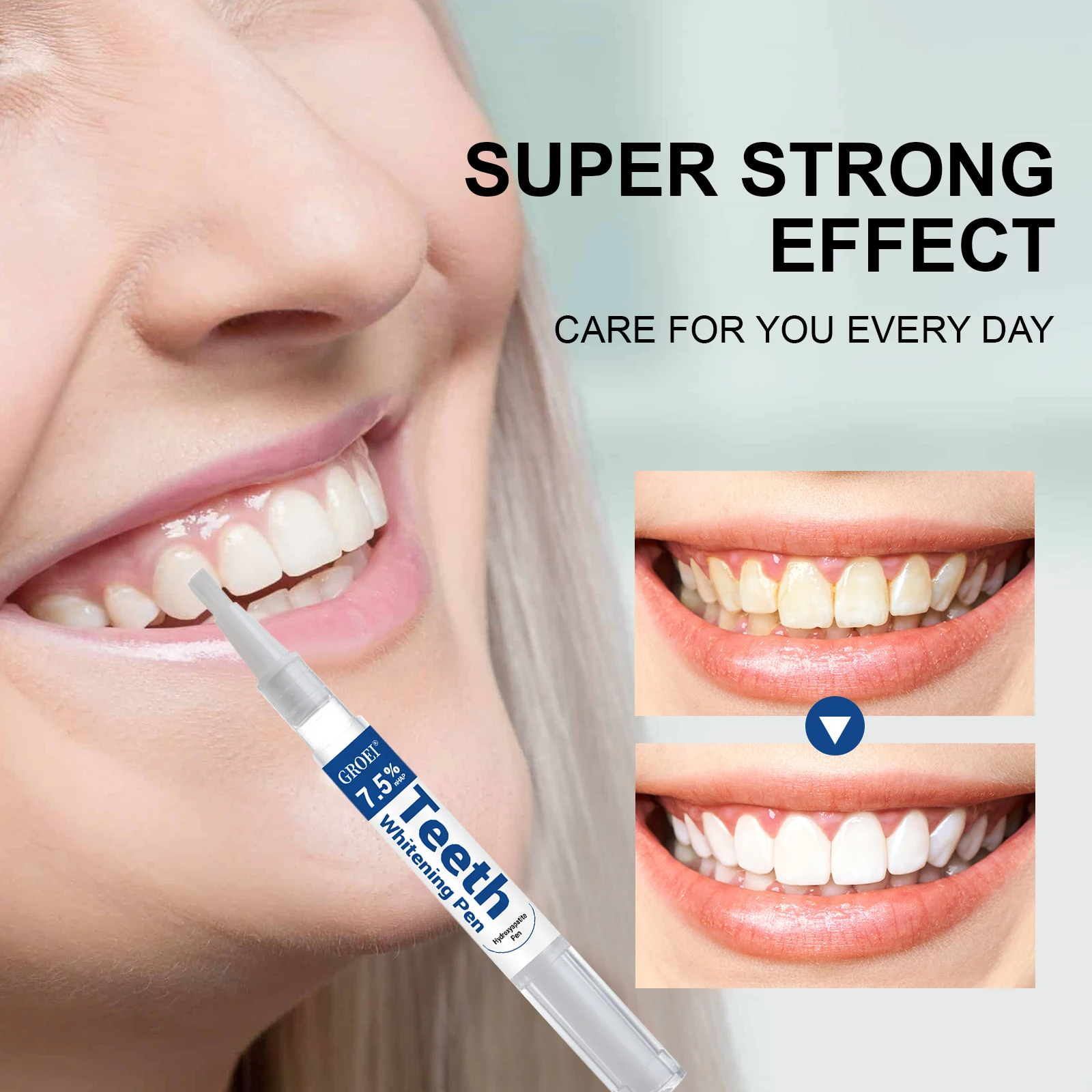 Stylo de blanchiment des dents - Teeth Whitening Results avis et prix