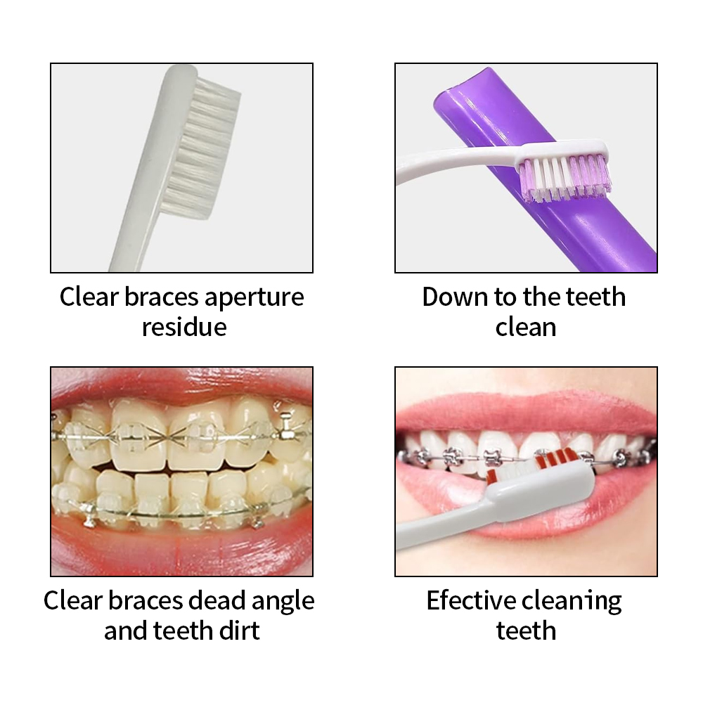 Kit de brosses de soins dentai - Teeth Whitening With Braces avis et prix