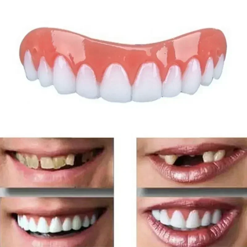 Nouvelles fausses dents en sil - Teeth Whitening With Braces avis et prix