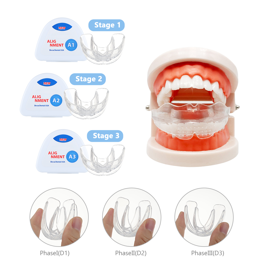 Ensemble de bretelles orthodon - Teeth Whitening With Braces avis et prix