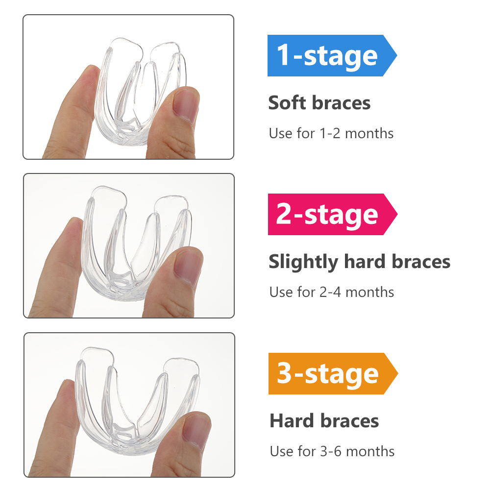 Ensemble de bretelles orthodon - Teeth Whitening With Braces avis et prix