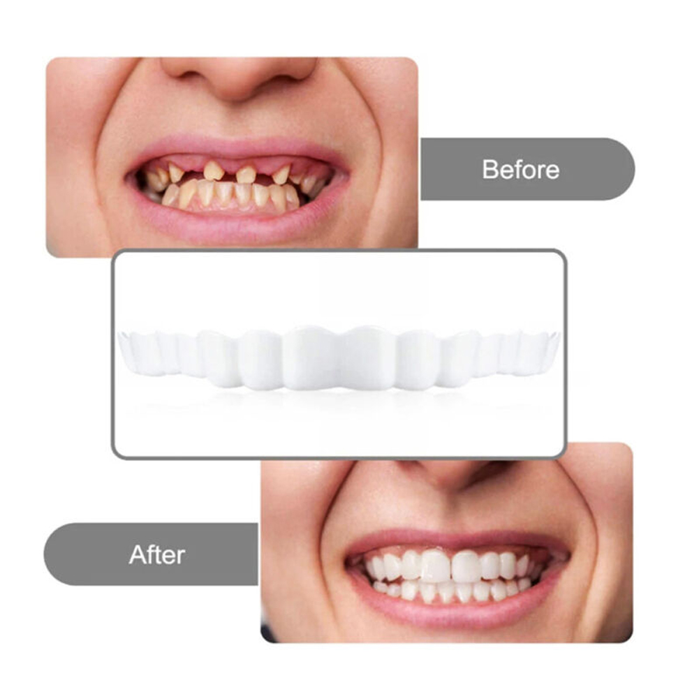 4-6 paires de prothèses dentai - Teeth Whitening Mask avis et prix