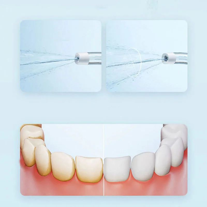 Xiaomi Irrigateur buccal porta - Teeth Whitening Quick avis et prix
