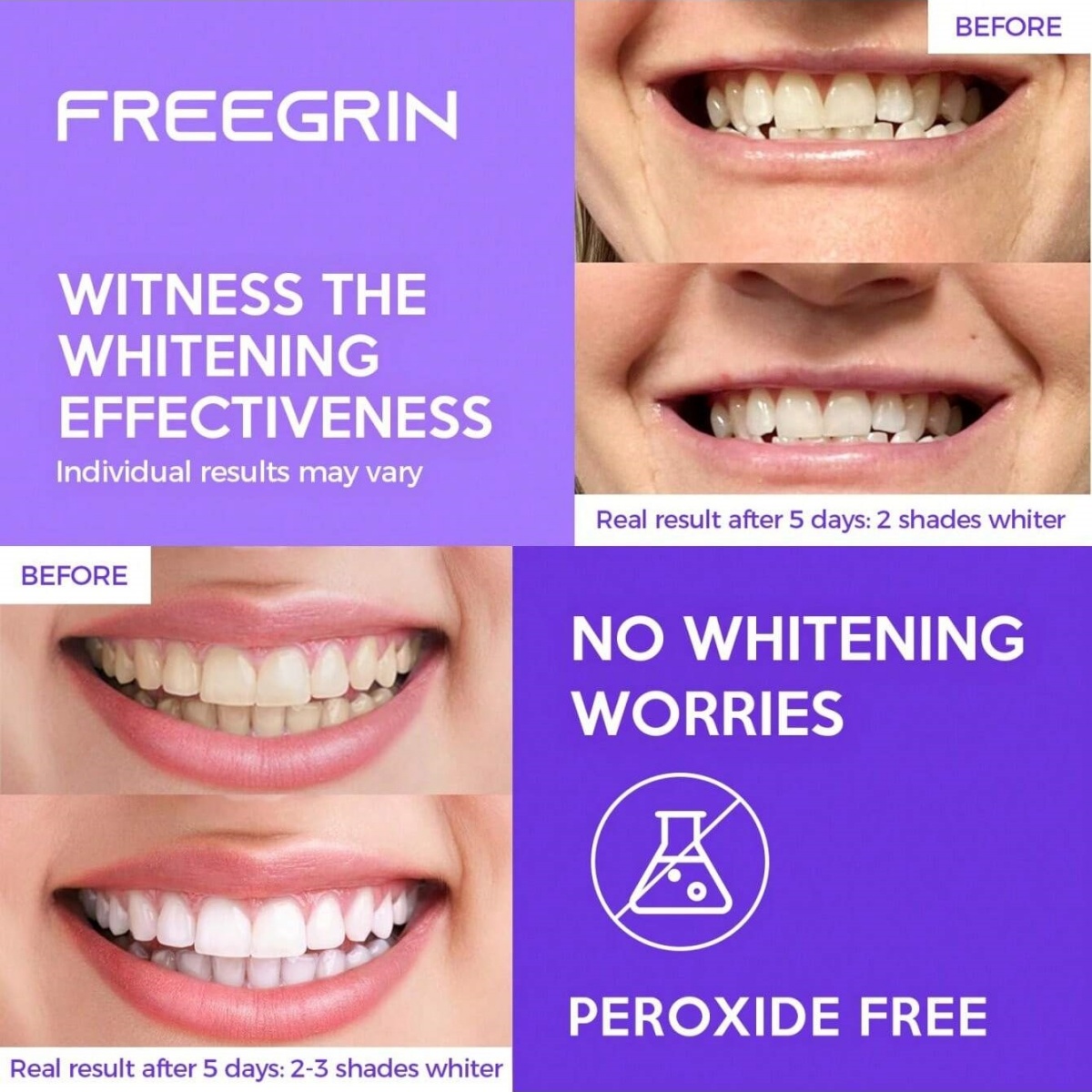 Autocollants de blanchiment de - Teeth Whitening Results avis et prix